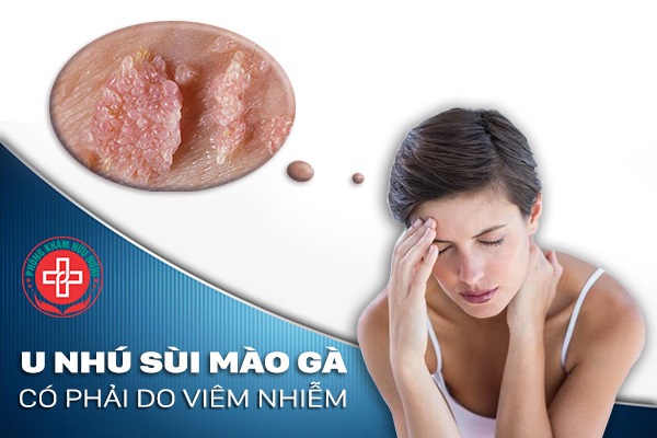 U nhú sùi mào gà có phải do viêm nhiễm