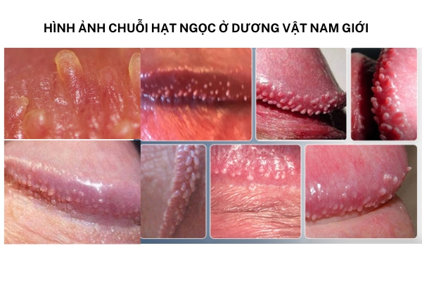 chuoi-hat-ngoc-nam