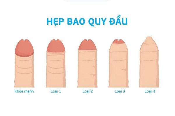 Cơ sở y tế cắt hẹp bao quy đầu uy tín